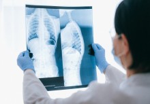 Doktor trzyma zdjęcie prześwietlenia płuc - powiększ